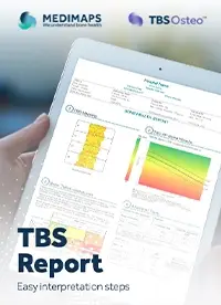 TBS Osteo example report