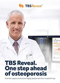 TBS Reveal brochure