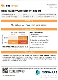 TBS Reveal example report