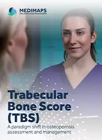 TBS white paper